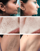 Depilador Facial Batom Eléctrico Feminino PickMeDeals